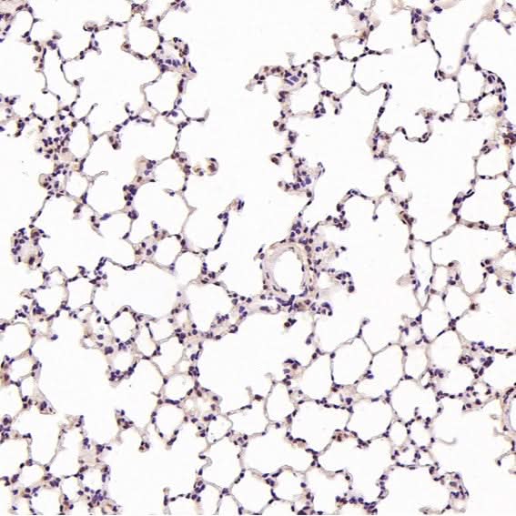Anti-Hsc70 HSPA8 Rabbit Monoclonal Antibody Boster Bio