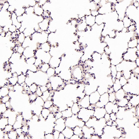 Anti-Hsc70 HSPA8 Rabbit Monoclonal Antibody Boster Bio