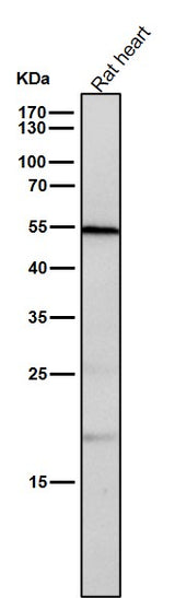 Anti-CD209 Rabbit Monoclonal Antibody Boster Bio
