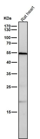 Anti-CD209 Rabbit Monoclonal Antibody Boster Bio