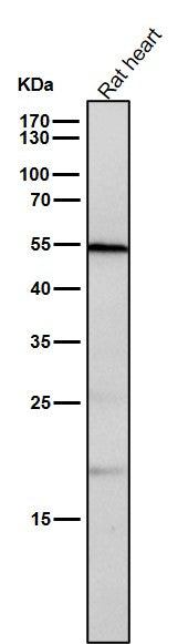 Anti-CD209 Rabbit Monoclonal Antibody Boster Bio
