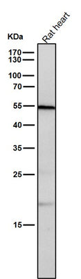 Anti-CD209 Rabbit Monoclonal Antibody Boster Bio