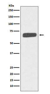 Anti-Collagen X COL10A1 Rabbit Monoclonal Antibody Boster Bio