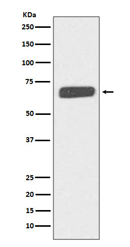 Anti-Collagen X COL10A1 Rabbit Monoclonal Antibody Boster Bio