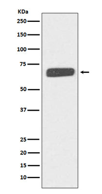 Anti-Collagen X COL10A1 Rabbit Monoclonal Antibody Boster Bio