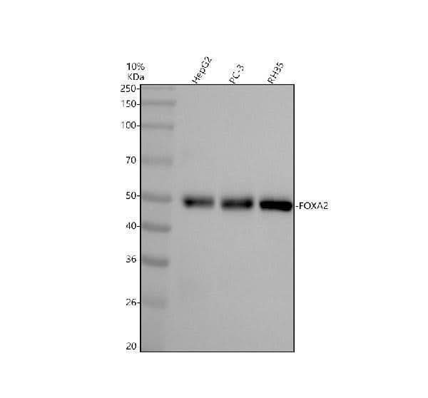 Anti-FOXA2/Hnf3B Rabbit Monoclonal Antibody Boster Bio
