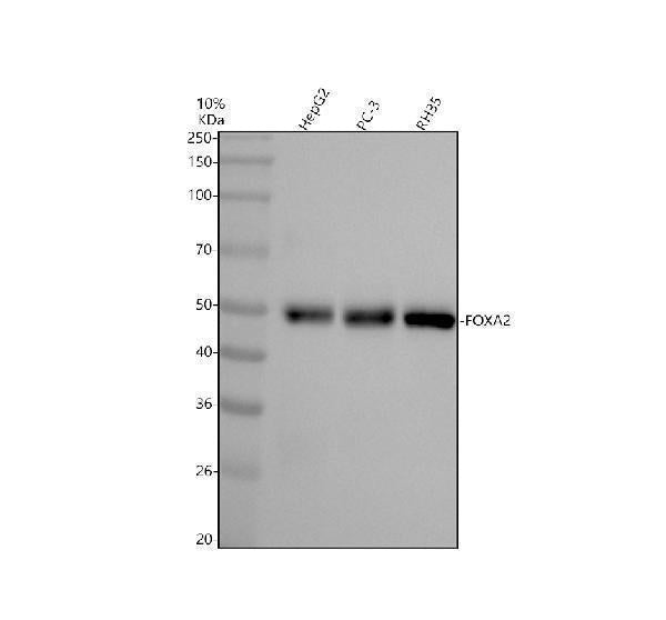 Anti-FOXA2/Hnf3B Rabbit Monoclonal Antibody Boster Bio