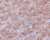 Anti-Paxillin PXN Rabbit Monoclonal Antibody Boster Bio