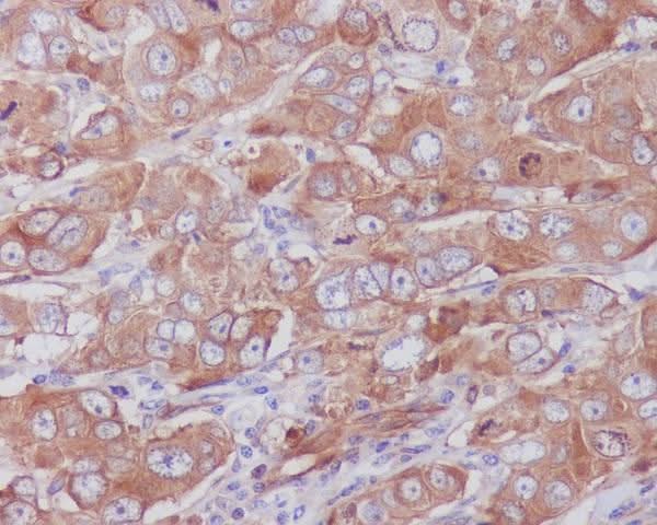 Anti-Paxillin PXN Rabbit Monoclonal Antibody Boster Bio