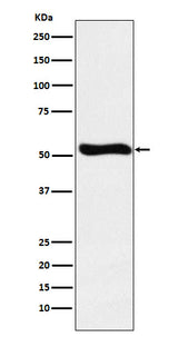 Anti-Lumican Rabbit Monoclonal Antibody Boster Bio