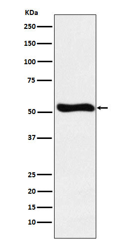 Anti-Lumican Rabbit Monoclonal Antibody Boster Bio