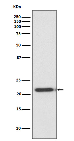 Anti-TIMP2 Rabbit Monoclonal Antibody Boster Bio