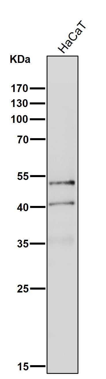 Anti-NeuroD1 Rabbit Monoclonal Antibody Boster Bio
