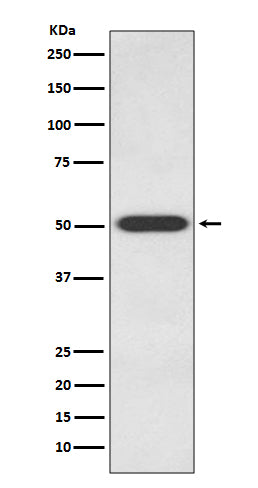 Anti-Endothelin B Receptor EDNRB Rabbit Monoclonal Antibody Boster Bio