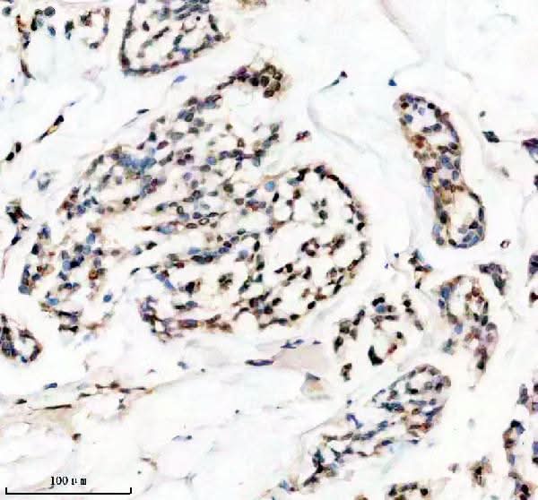 Anti-HMGA1 Rabbit Monoclonal Antibody Boster Bio