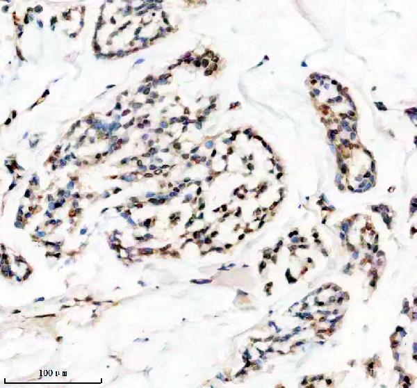 Anti-HMGA1 Rabbit Monoclonal Antibody Boster Bio