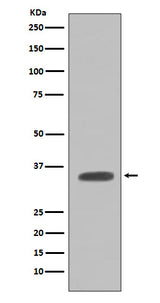 Anti-Caspase-7 Casp7 Rabbit Monoclonal Antibody Boster Bio