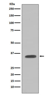 Anti-Caspase-7 Casp7 Rabbit Monoclonal Antibody Boster Bio