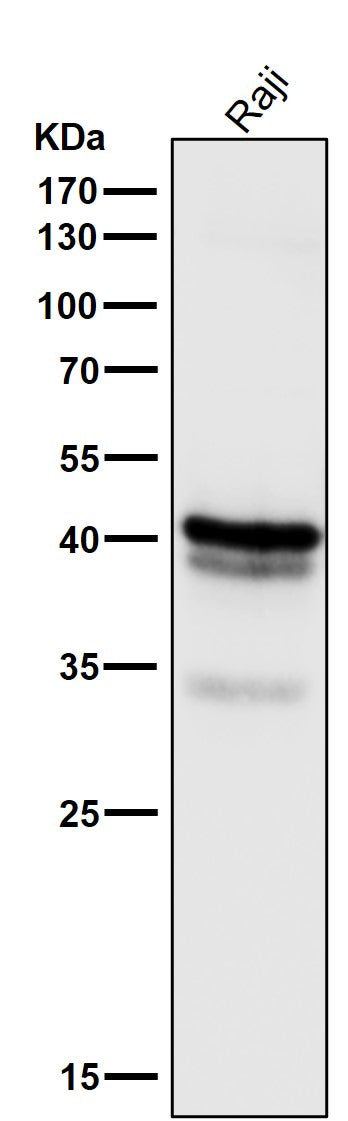 Anti-CD79a Monoclonal Antibody Boster Bio