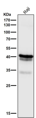 Anti-CD79a Monoclonal Antibody Boster Bio