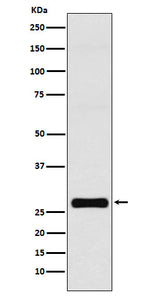 Anti-GJB1 Rabbit Monoclonal Antibody Boster Bio