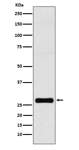 Anti-GJB1 Rabbit Monoclonal Antibody Boster Bio