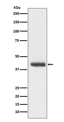 Anti-DCX/Doublecortin Rabbit Monoclonal Antibody Boster Bio