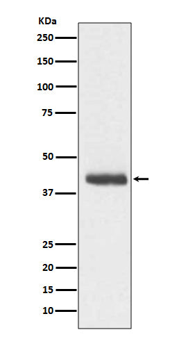 Anti-DCX/Doublecortin Rabbit Monoclonal Antibody Boster Bio