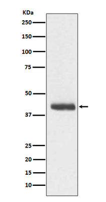 Anti-DCX/Doublecortin Rabbit Monoclonal Antibody Boster Bio