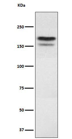 Anti-EHMT2 Rabbit Monoclonal Antibody Boster Bio
