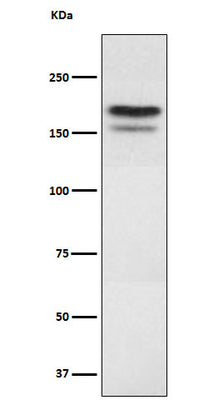 Anti-EHMT2 Rabbit Monoclonal Antibody Boster Bio