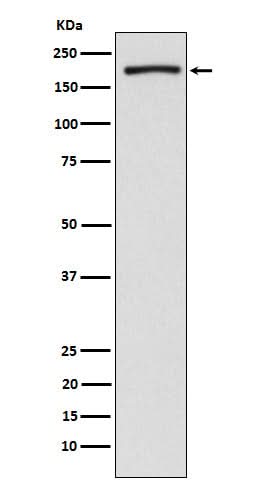 Anti-EHMT2/G9A Rabbit Monoclonal Antibody Boster Bio