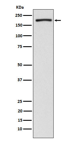 Anti-EHMT2/G9A Rabbit Monoclonal Antibody Boster Bio