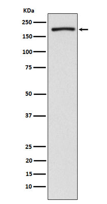 Anti-EHMT2/G9A Rabbit Monoclonal Antibody Boster Bio