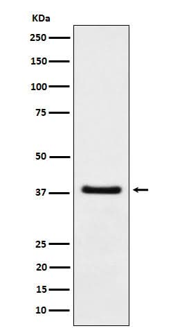 Anti-HDGF Rabbit Monoclonal Antibody Boster Bio