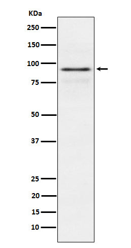 Anti-RSK1 p90 Rabbit Monoclonal Antibody Boster Bio