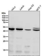 Anti-Chk1 CHEK1 Rabbit Monoclonal Antibody Boster Bio