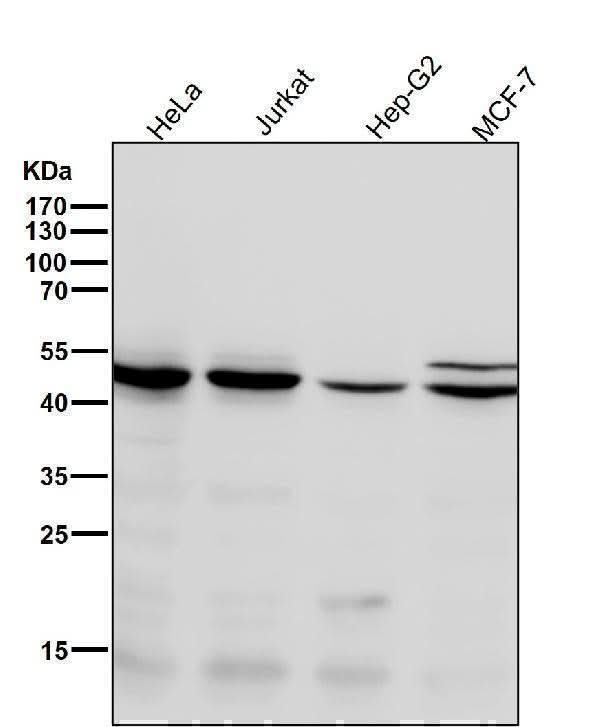 Anti-Chk1 CHEK1 Rabbit Monoclonal Antibody Boster Bio
