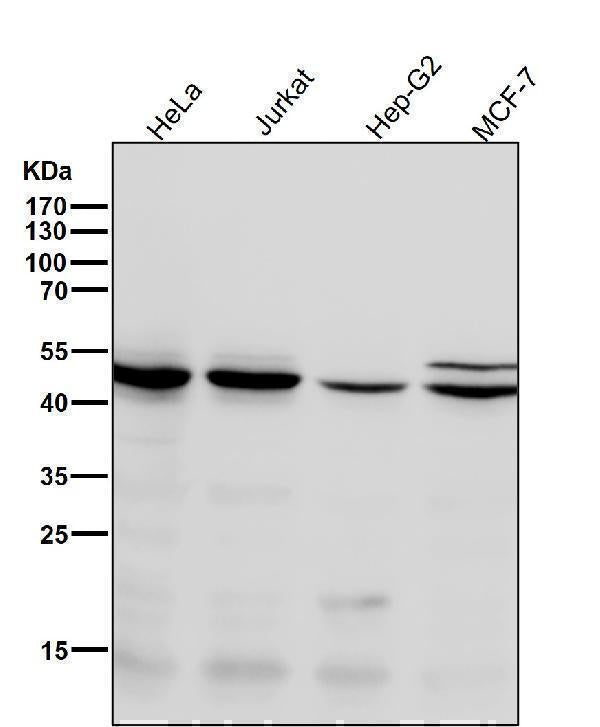 Anti-Chk1 CHEK1 Rabbit Monoclonal Antibody Boster Bio