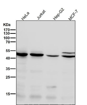 Anti-Chk1 CHEK1 Rabbit Monoclonal Antibody Boster Bio