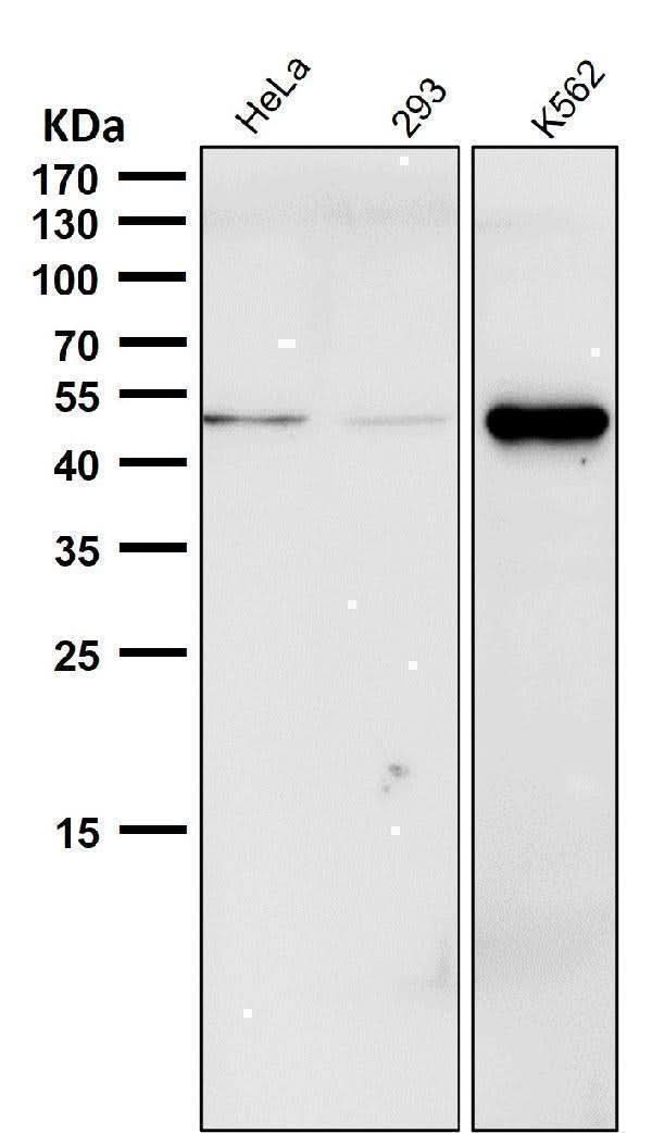 Anti-Phospho-Chk1 (S280) Rabbit Monoclonal Antibody Boster Bio