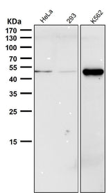 Anti-Phospho-Chk1 (S280) Rabbit Monoclonal Antibody Boster Bio