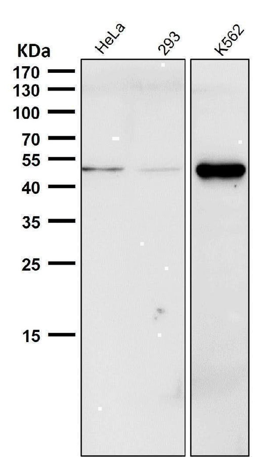 Anti-Phospho-Chk1 (S280) Rabbit Monoclonal Antibody Boster Bio