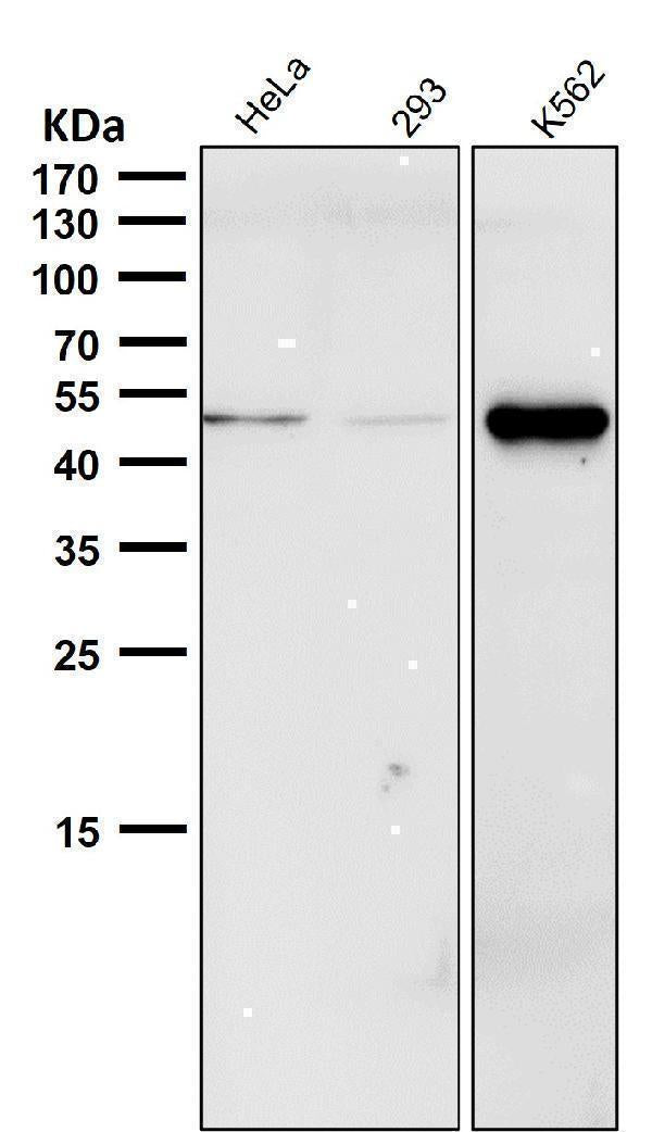 Anti-Phospho-Chk1 (S280) Rabbit Monoclonal Antibody Boster Bio