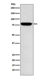 Anti-RANK Rabbit Monoclonal Antibody Boster Bio