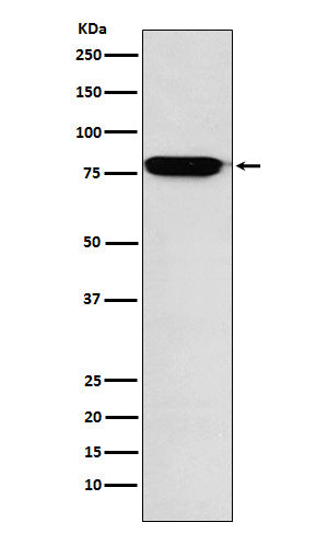 Anti-RANK Rabbit Monoclonal Antibody Boster Bio