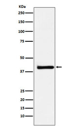 Anti-XRCC3 Rabbit Monoclonal Antibody Boster Bio