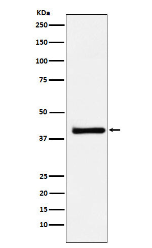 Anti-XRCC3 Rabbit Monoclonal Antibody Boster Bio