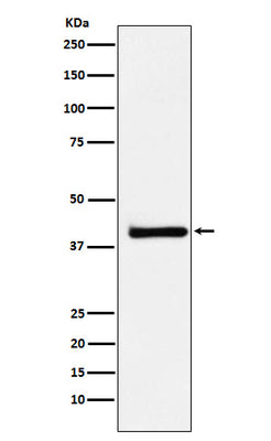 Anti-XRCC3 Rabbit Monoclonal Antibody Boster Bio