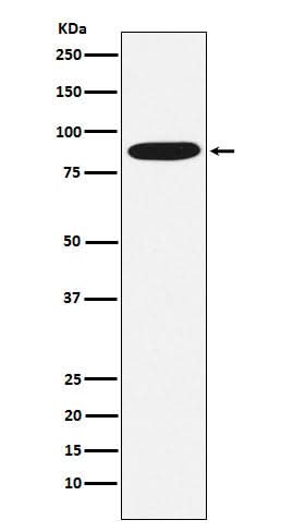 Anti-MST1 Rabbit Monoclonal Antibody Boster Bio